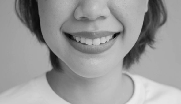 Diseño De Sonrisa Maxilo Martinez